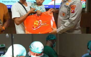 Polda Kalteng Gelar operasi Bibir Sumbing di Hari Bhayangkara ke-80 Polda Kalteng Gelar operasi Bibir Sumbing di Hari Bhayangkara ke-80